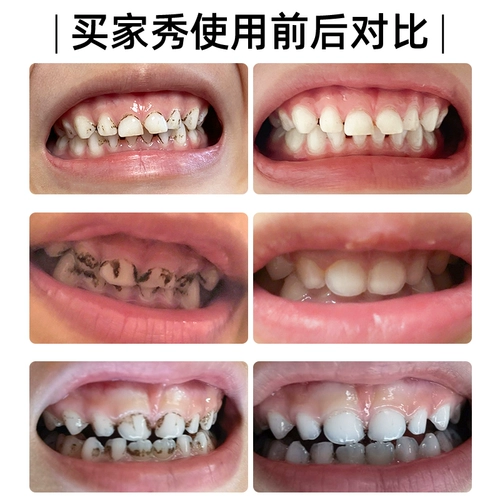 Японские детские чистящие зубы втирают зубной резин