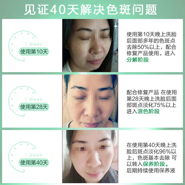 ແທ້ຈິງອຸດສາຫະກໍາແລະການຄ້າອະນຸມັດ Yipin Lotus Freckle Remover 15ML Special Number SF Express Express ບໍ່ແມ່ນ Yiyi Fulai Official Flagship Store