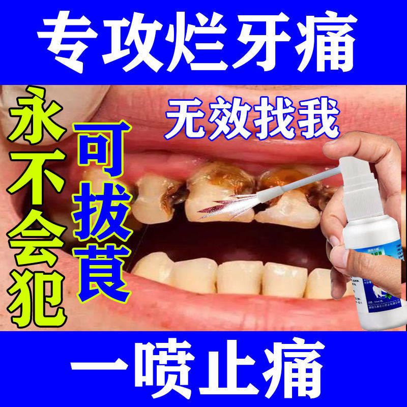 Toothache painkiller quick-acting artifact cures swollen gums and pain, can stop immediately, specializing in rotten tooth root flesh to reduce inflammation and pain nerves