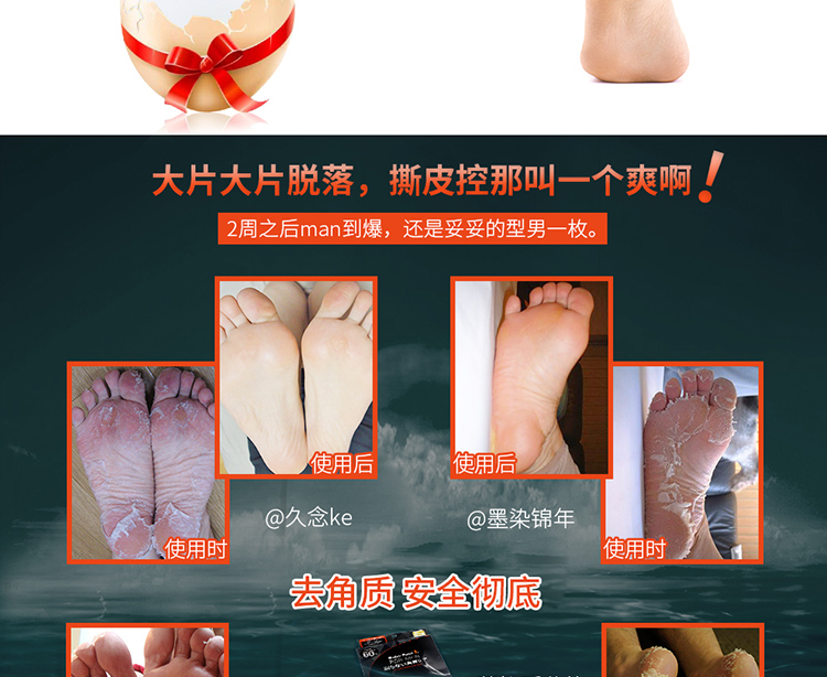 Nhật Bản nhập khẩu bé chân chân phim chân phim để da chết callus tẩy tế bào chết bàn chân đẹp dịu dàng chăm sóc bàn chân ủ lột da chân