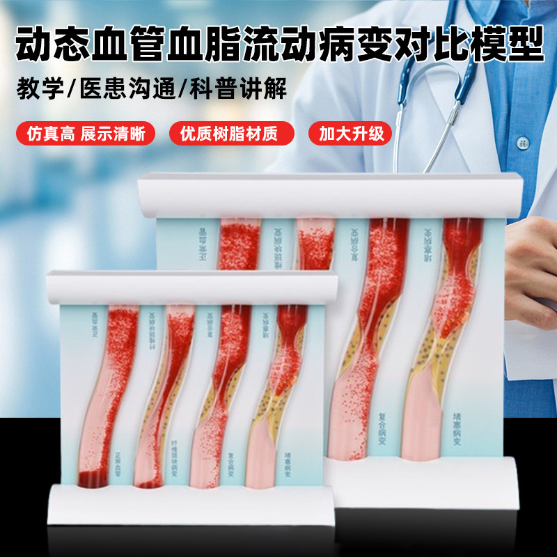 仿真动态血管血脂流动病变对比动脉硬化完全堵塞直观教学模型