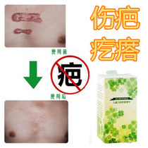 Pimple removal for children during caesarean section raised stitches caesarean section scars scars tattoos surgery scratches falls bumps scars