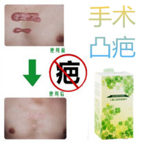 灵缝针烟烫剖宫产突起疙瘩破宫产刀伤巴痕烟疤手术抓伤摔伤撞伤疤