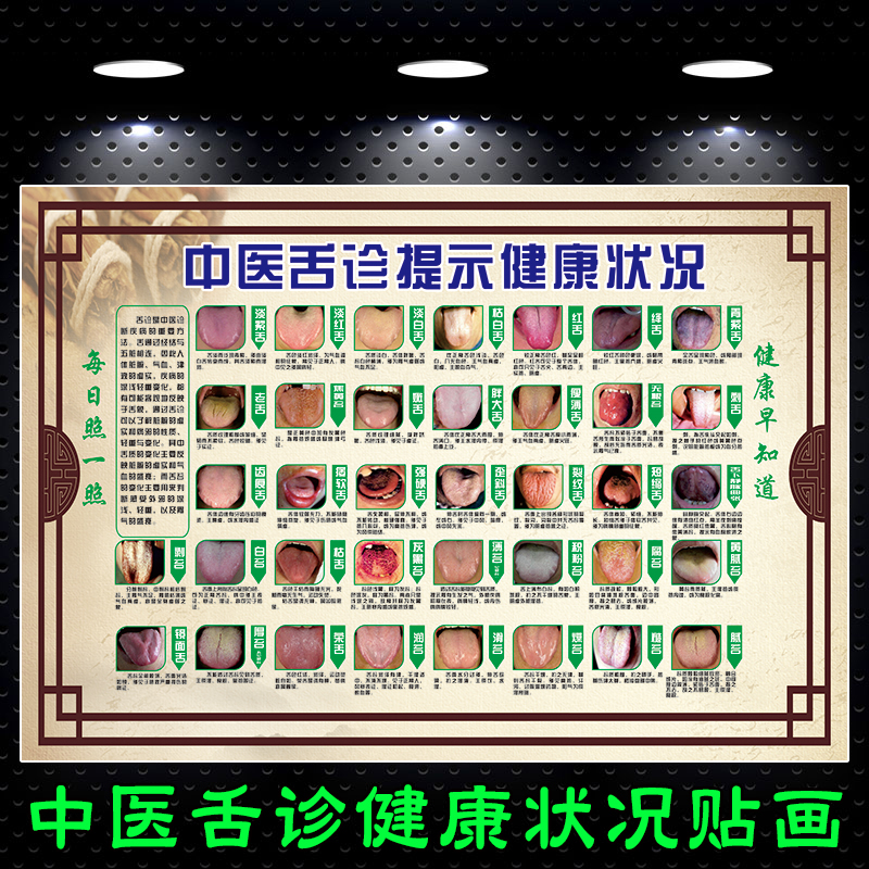 TCM Tongue Consultation Reminder Health Status Poster Posting Painting Oral Hospital Clinic Physique Discernment Decoration Large Wall Chart