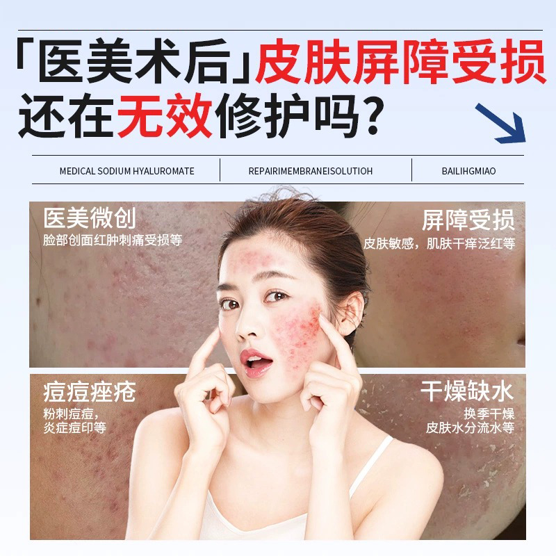 氧尚生物膜创面敷料面膜型医用冷敷贴,让你的肌肤享受专业级呵护!🌟