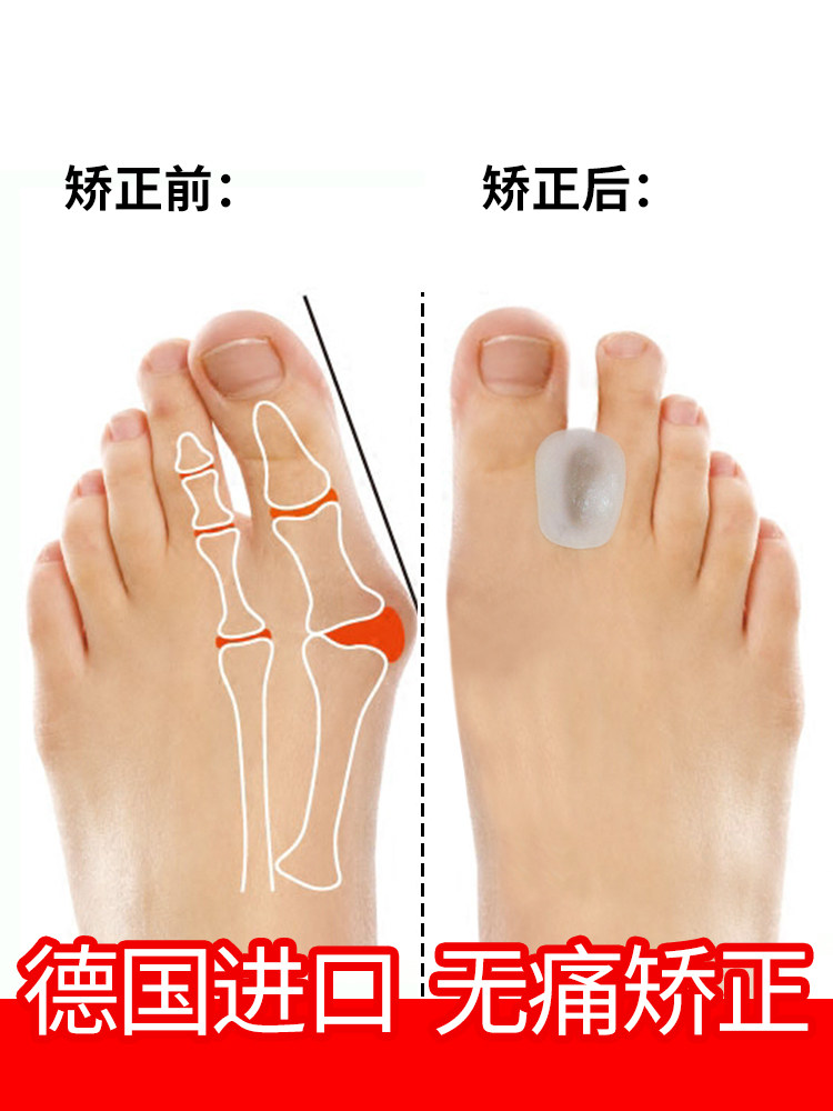 gehwol silicone toe cover Big toe valgus extrusion toe splitter correction protective plug toe plug toe column
