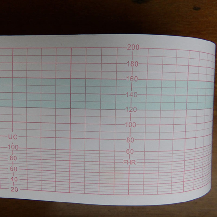 57mm Wide Roll Type Tire of Fetal Heart Photocopy Paper 57 * 40 Tire Supervision Paper 57 * 20 Fetal Supervision Boree Tire of Supervisors