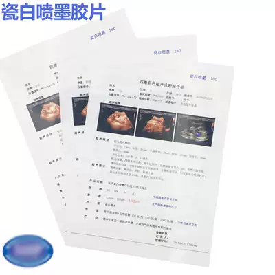 Porcelain White Inkjet Hospital Printing Film A4A316KB5 Color Waterproof Film Gastroscopy Pathology B- Ultrasound Department