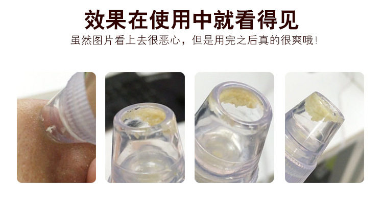 Blackhead Beauty Instrument_11
