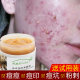 Grandma's Herbal Mite Acne Remover Cream ຄີມແກ້ສິວ ຝ້າ ກະ ຈຸດດ່າງດຳ ແກ້ສິວ ຝ້າ ກະ ຈຸດດ່າງດຳ