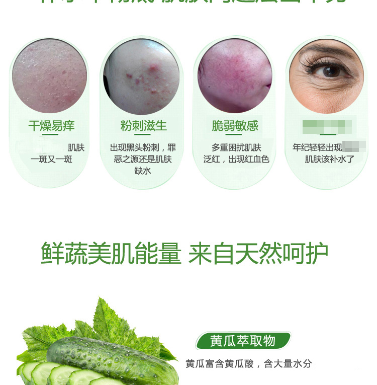 Thái Lan phiên bản chính hãng Thái Lan BOOTS kem dưa chuột 100ML phụ nữ mang thai có sẵn hydrating kem dưỡng da cho nam
