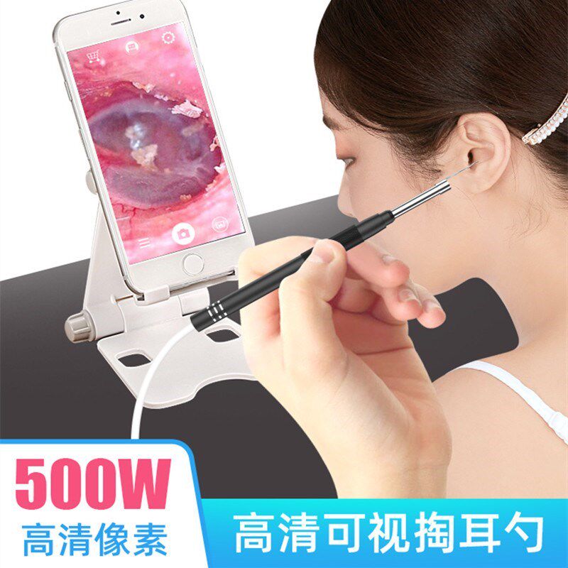 Ear-digging adults use the ear-digging endoscope to dig the ear artifact to visualize the ear-digging tool of the ear-digging spoon