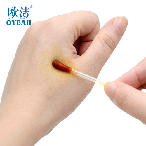 Ou Yan поднимает Meng Yan йодофор йодофор 100 младенец пупок, чтобы рассеять вихрь Yue 耷 Лень