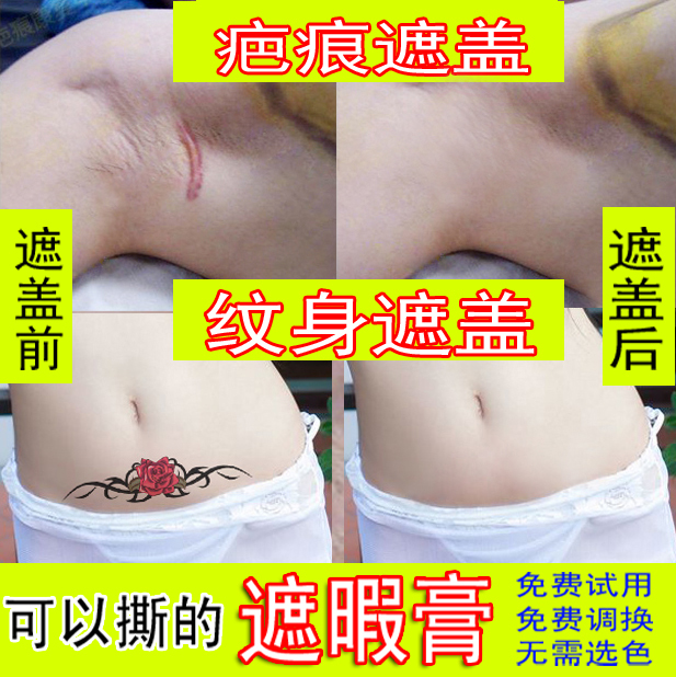 Covering Tattoos, Birthmarks, Scars, Postpartum Repair for Pregnant Women, Human Skin Suturing, Medical High-Quality Imitation Human Skin Glue Covering Tattoos, Birthmarks, Scars, Postpartum Repair for Pregnant Women, Human Skin Suturing, Medical High-Quality Imitation Human Skin Glue