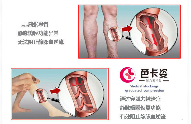 Chaussettes - collants B10 - Ref 763113 Image 10