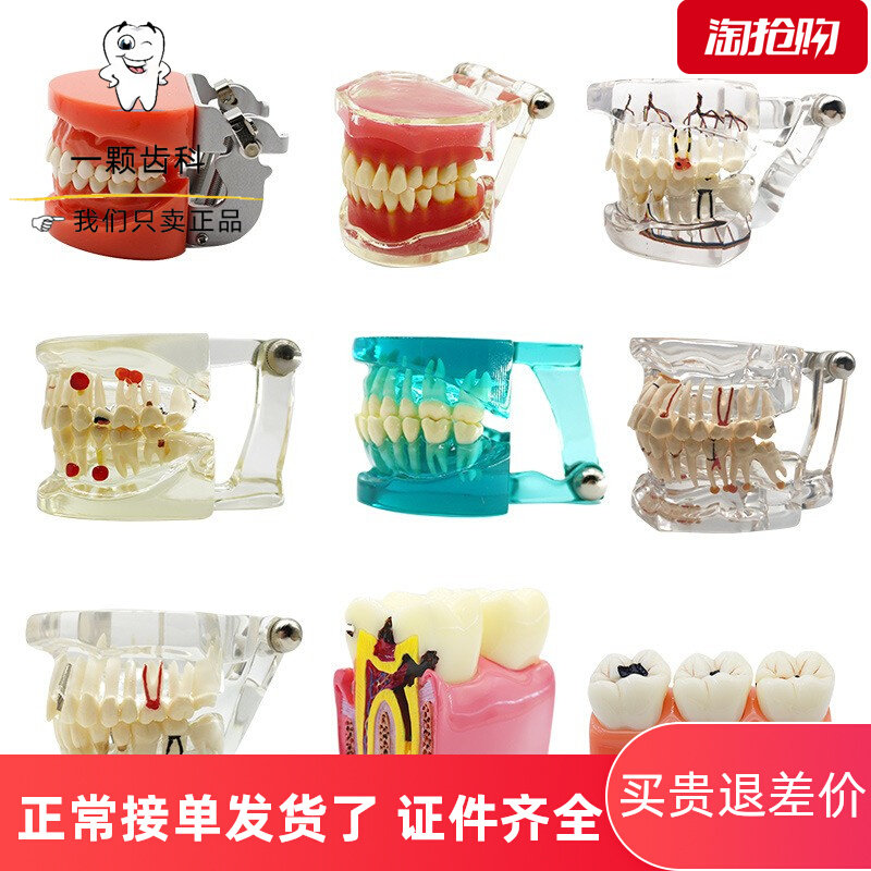 Oral standard dental model cultivation of detachable neurodothoral modifier tooth repair tooth tooth tooth tooth tooth tooth tooth tooth communication model