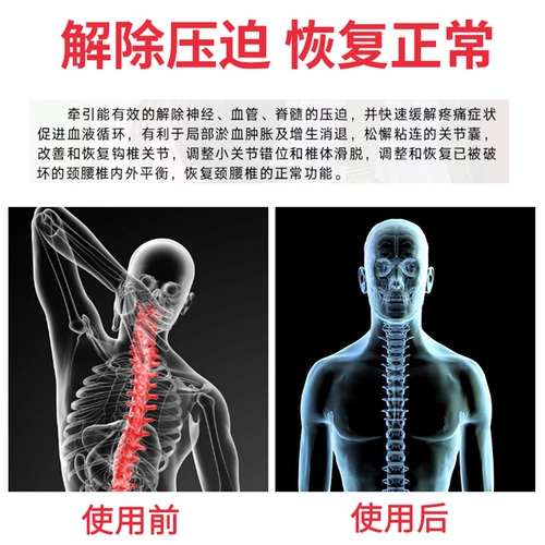 助邦 Шейки матки поясничное тяговое устройство домохозяйство исправить обработку поясничного отдела позвоночника