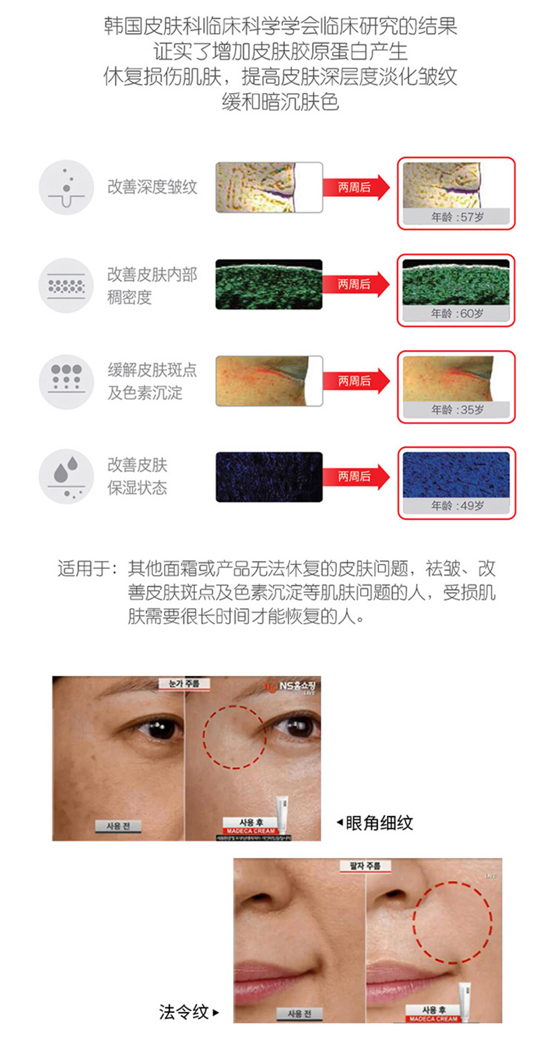 Tu Ge chính hãng Hàn Quốc Dongguo Dược phẩm kem mặt centellian Centella asiatica sửa chữa kem nước nhẹ kim giữ ẩm - Kem dưỡng da kem dưỡng nivea