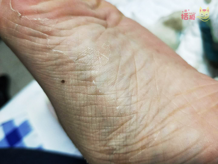 Lột mặt nạ chân đặt cho da chết cũ dịu dàng dịu dàng gót chân khô nứt chân phim dịu dàng chân tẩy tế bào chết bộ chăm sóc bàn chân kem dưỡng ẩm tay chân