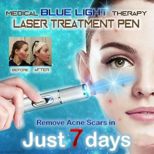Heath Blue Light Therapy Varicose VE Learch Lazer Pen SOF