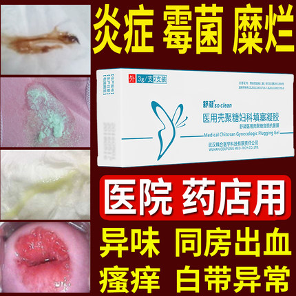 壳聚糖妇科填塞炎症凝胶重度宫颈糜烂白带多黄