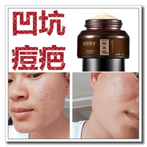 Acne pit repair pit removal acne scar removal acne scar removal pore shrinkage and sunken regeneration factor for men