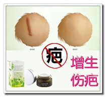 Concealer removes uneven scars removes tobacco scars conceals patches and fades melanin and aloe vera gel acne marks in private parts.