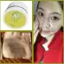 Kem rửa mặt, làm sạch sâu lỗ chân lông, kem massage trị mụn đầu đen, kem massage mặt, chì, độc tố thủy ngân, thẩm mỹ viện