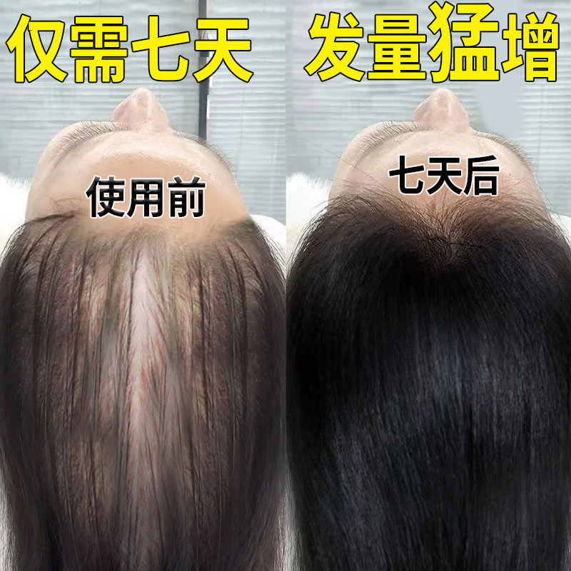 (short I eat) hair natural growth speed between men and women hair speed Mie-Taobao