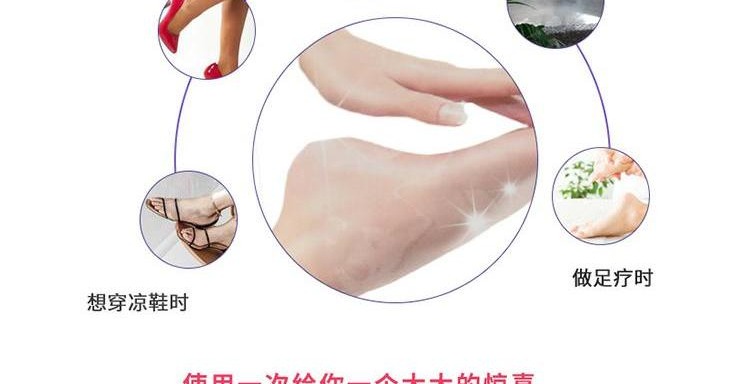 k chị yêu làm đẹp Nhật Bản MiiMeow Mi a đi da chết da chân chăm sóc da kem trị nứt gót