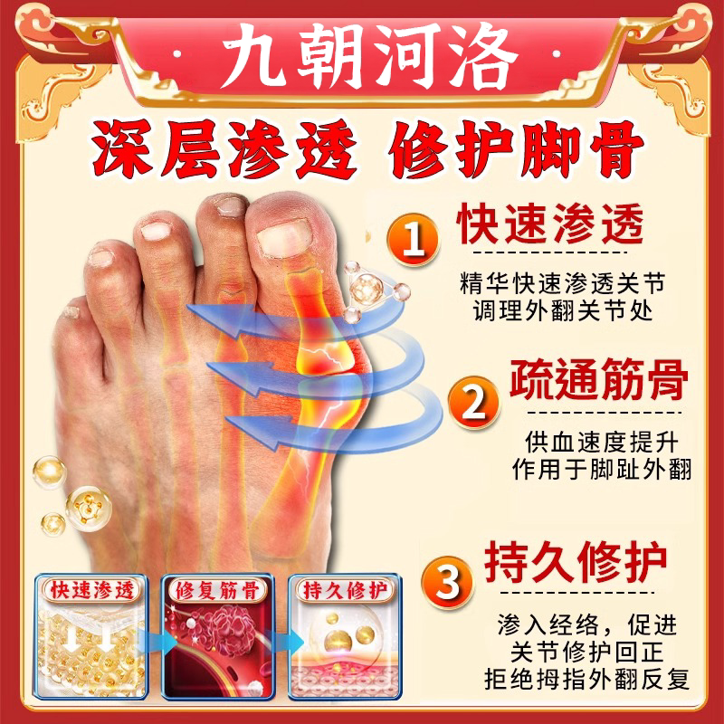 拇外翻神器：拇囊炎疼痛脚趾外翻关节重叠形疼痛特效贴，告别疼痛，重塑美丽足部！-足部按摩走毯-淘宝好物网
