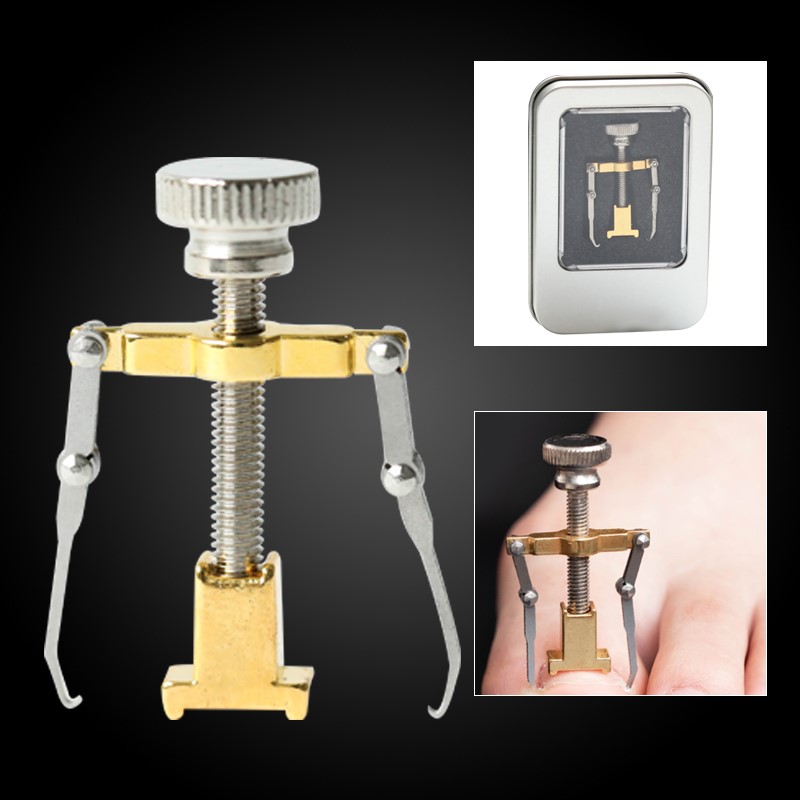 Positive nail buckle nail sticker nail correction device toe embedded nail groove embedded nail long meat correction