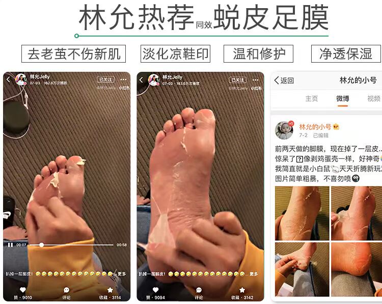 Lin Yun với mặt nạ chân ngựa Nhật Bản chăm sóc chân đến da chết già sừng chân mềm gót chân khô nứt. kem bôi gót chân