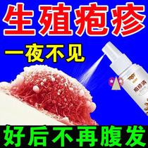 New Herpes Breaks Root herpes Kerch extraterrestrial anti-relapsing genital herpes virus male lynching shingles herpes zoster