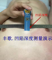 Qingdao Fengge funnel chest depth measurement ruler blue silver optional adult children at home check the degree of depression