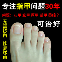 The effect is great (refundable if not used). Just drop a drop of it and the bad nails will turn into good ones. Ajonyjing will help you enjoy a good nail life.