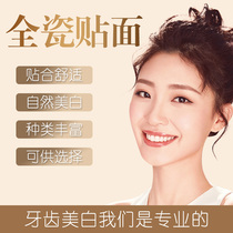 Teeth Veneers Full Ceramic Teeth Veneers Ivoclar Full Porcelain Teeth Veneers Teeth Veneers Full Porcelain Teeth Veneers Whitening Teeth Patch