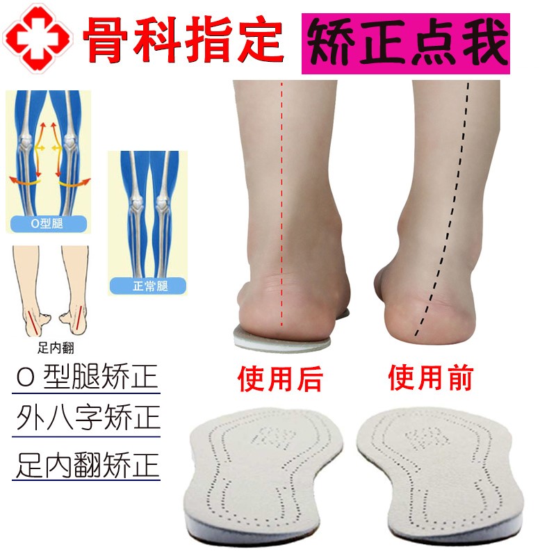 Turn over the outside of the shoe to wear the insole with the inside and outside the eight-shaped o-shape correction heightening correction insole o-leg flat foot