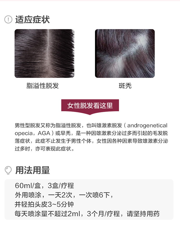 达霏欣 女用2%米诺地尔 治疗脂溢性脱发 60ml 图3