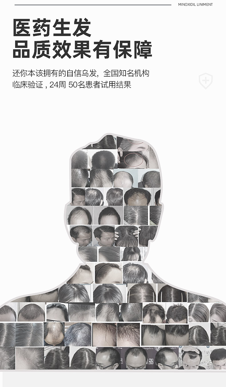 达霏欣 2%米诺地尔酊搽剂 防脱发生发增发液 30ml 图10