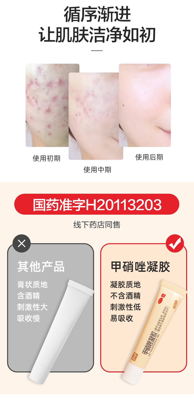 阿里健康大药房 碧生源 甲硝唑凝胶药膏 祛痘祛粉刺毛囊炎 图5
