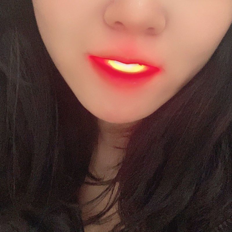 Bbh Same Style Internet Celebrity Glowing Braces That Light Up, Baekhyun's Hiphop Outfit, Led Hip-Hop Mouthguard, Disco Decoration