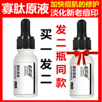 Xilali oligopeptide extract to dilute acne marks Acne pits acne scars Lyophilized powder Acne products Facial serum for men and women