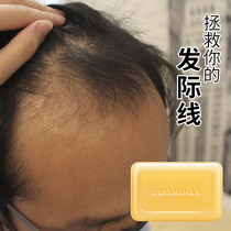 Shampoo soap-controlled oil removal of mites soap removal of mites ginger to dandruff anti-prickly anti-hair hair care soap fragrance lasting