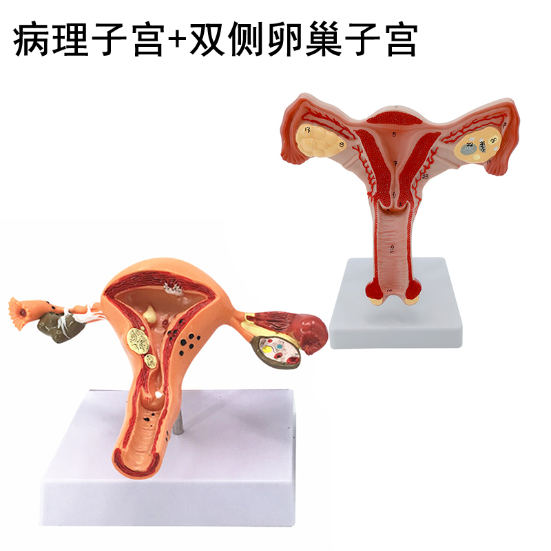 震惊！这居然是妇科医生都在用的私密教具？女性生殖模型全网最硬