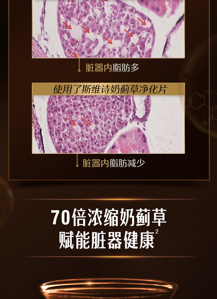 Swisse 斯维诗 高浓缩奶蓟草净化片 120粒 双重优惠折后￥146包邮包税