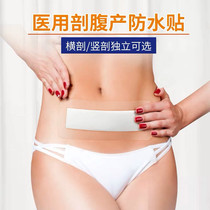 Caesarean section waterproof patch wound patch Maternal postoperative bath knife edge patch planing maternity breathable sterile applicator 5 packs