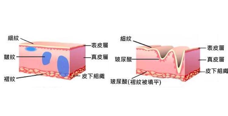 拒绝飞粉底妆，干皮妹秋冬这样做44