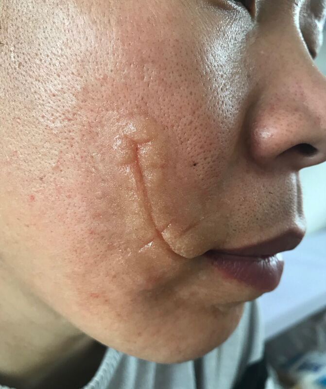 Film and Television Special Effects Makeup Scar Fake Skin Lip Cut Heath Ledger Imitation Makeup Cosplay Clown Realistic Wound Fake Scar Film and Television Special Effects Makeup Scar Fake Skin Lip Cut Heath Ledger Imitation Makeup Cosplay Clown Realistic Wound Fake Scar