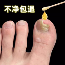(Refundable if invalid) Painless replacement of potassium enjoy a life of good nails turn bad nails into good ones drop by drop